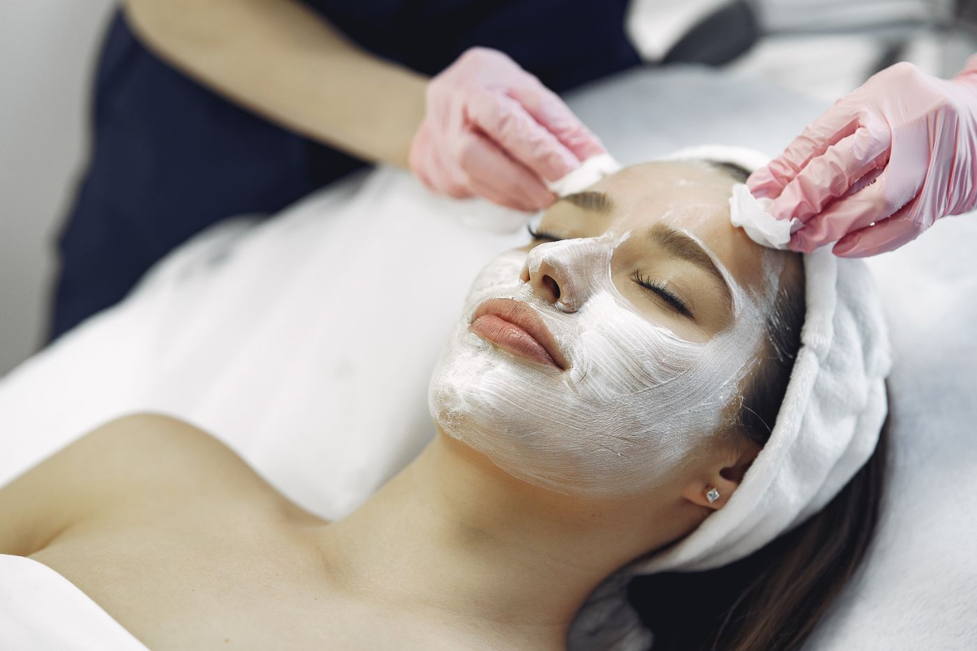 Chemische peel